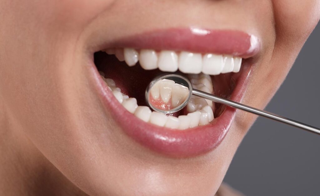 Oral Screening