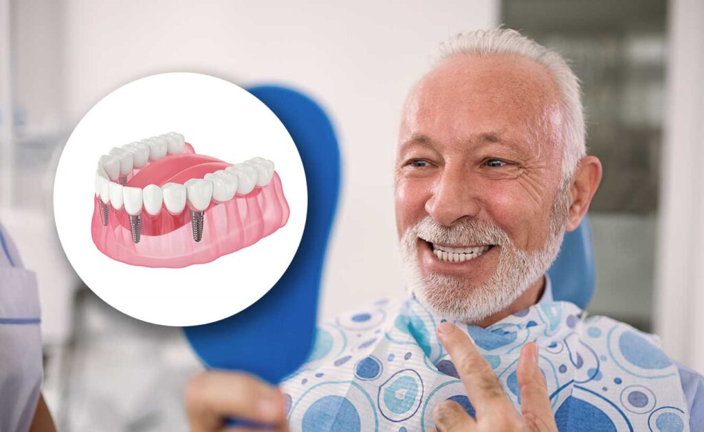 Dental Implants Jackson, MS Germany Dental Brandon, MS